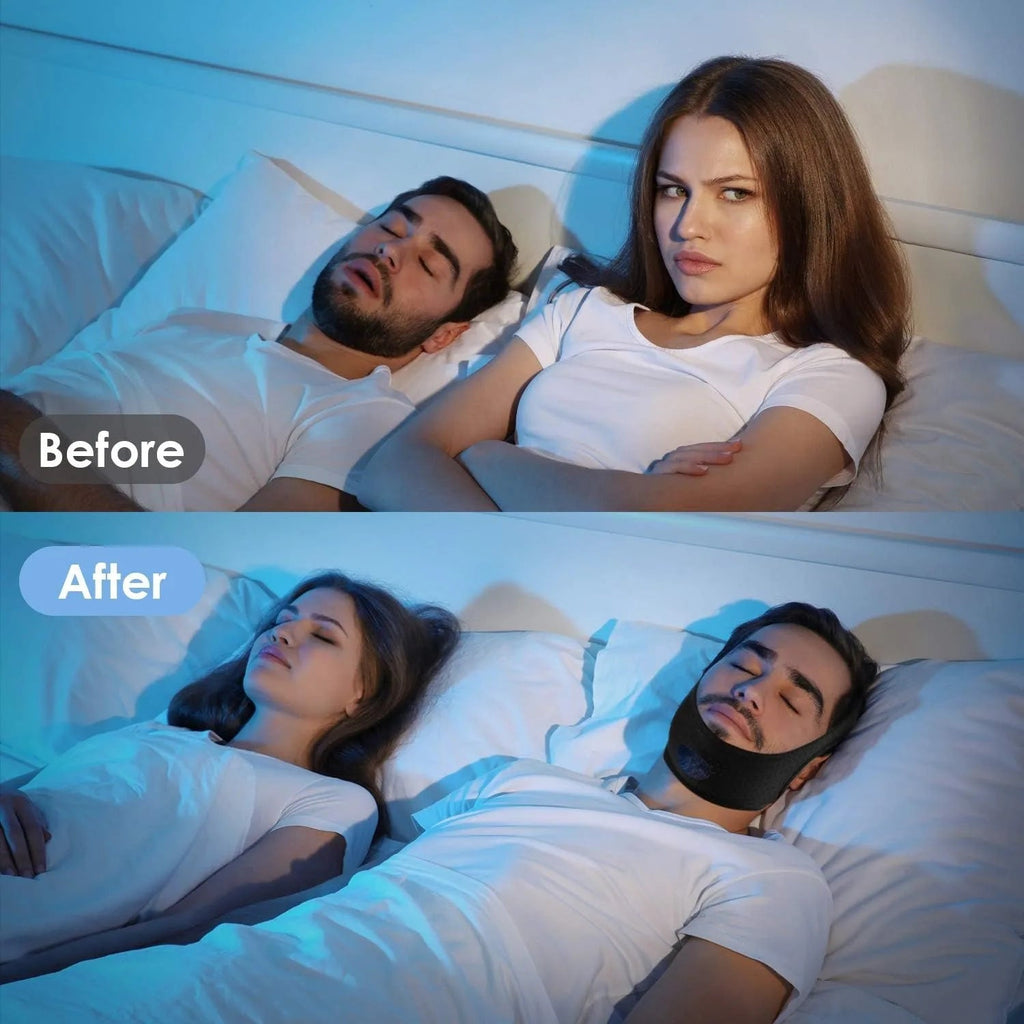 Anti Snoring Chin Strap My Store 3